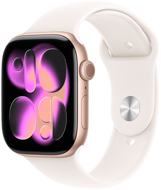 Apple Watch Series 11 1